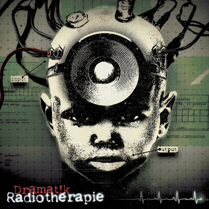 Radiothérapie 